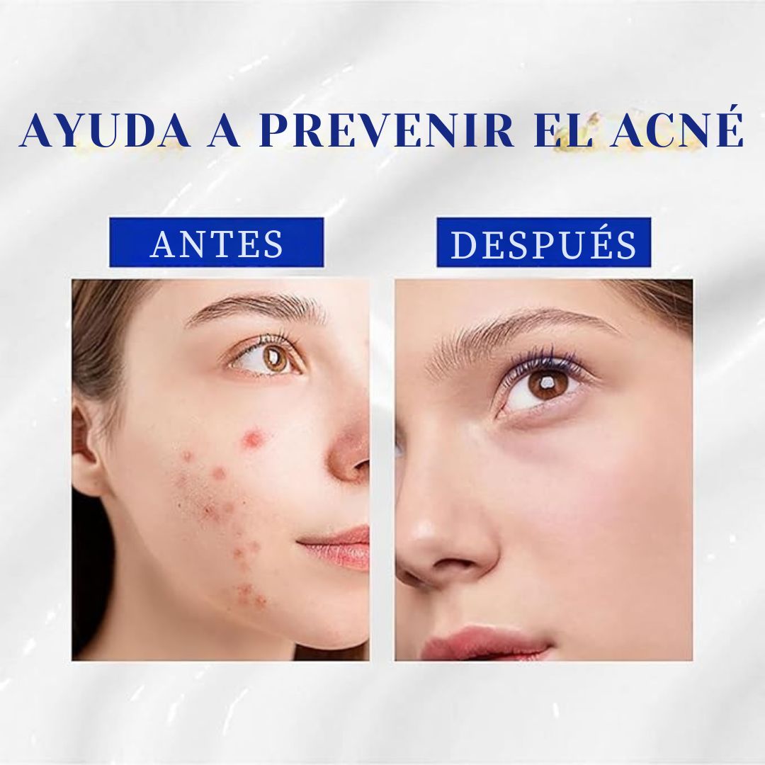 "A313: La Fórmula Perfecta de Retinol y Vitamina A para una Piel Radiante"