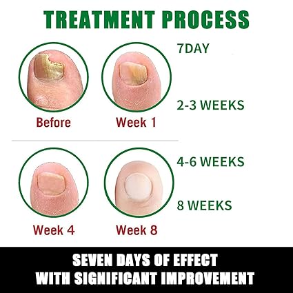 7 DAYS - ELIMINA HONGOS